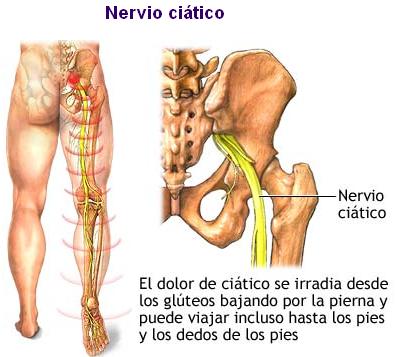 Nervio_Ciatico2[1]