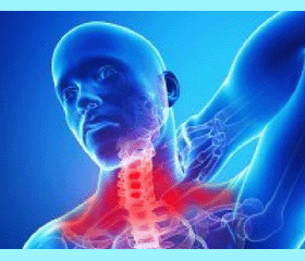thoracic-outlet-syndrome-symptoms-1[1]